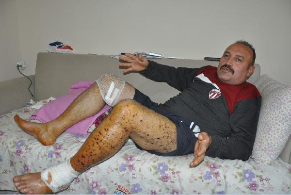 İki bombalı saldırıda yaralanan gazi polis, kendi isteği ile Cizre'de görev aldı
