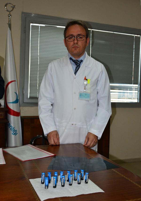 Mahkumun karnından 13 pil çıkarıldı