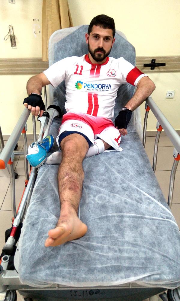 Ampute futbolcu, az kalsın tek bacağından da oluyordu