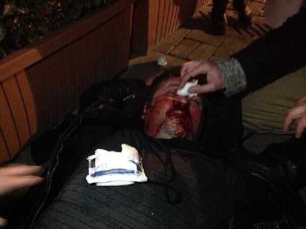 Polis kaskıyla burun kırılması soruşturması 22 aydır sürüyor