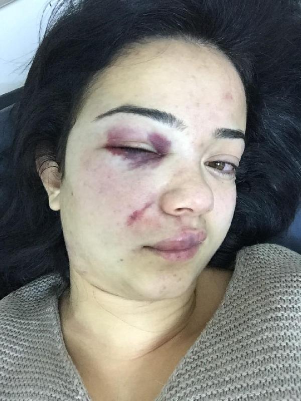 Boşandığı eşi, dövüp çocuğunu kaçırdı iddiası