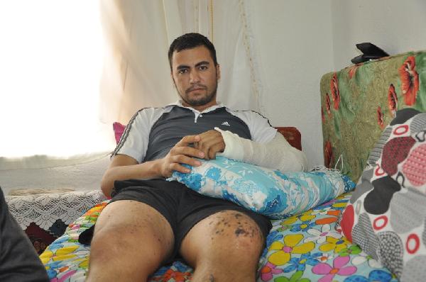 Yaralı komutanına yardım etmek isterken el bombasıyla yaralandı
