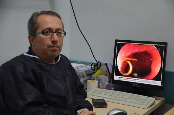 Çocukların yuttuğu cisimler görenleri şaşırtıyor