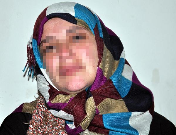 Suriyeli sığınmacı kadın: Rejim askerleri cezaevinde tecavüz etti