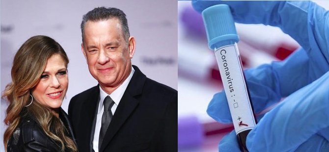 Tom Hanks ve eşi virüse yakalandı