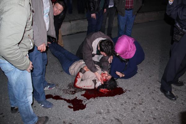 Zonguldak'ta halk otobüsünün çarptığı genç kız ağır yaralandı