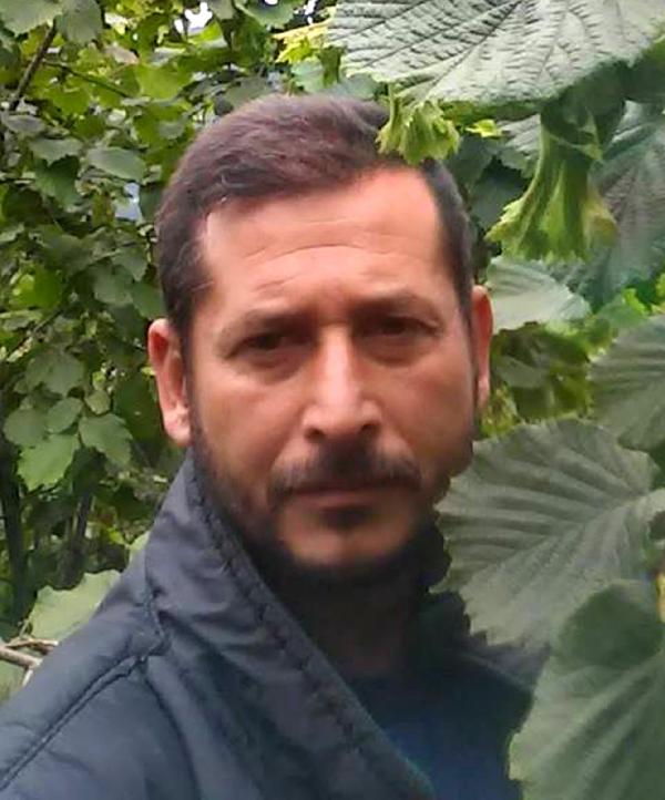 Ayının parçaladığı yüzü Prof. Dr. Özkan tedavi edecek