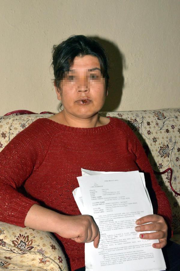 Ayrıldığı sevgilisine karşı koruma istedi