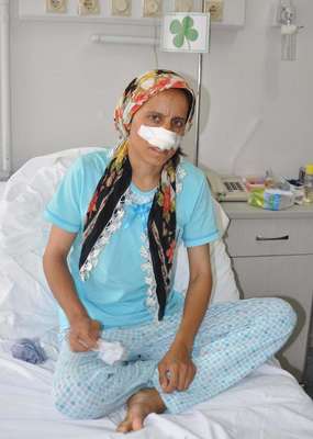 Eşinin burnunu kesen koca hakkında işkence suçundan da ceza istendi