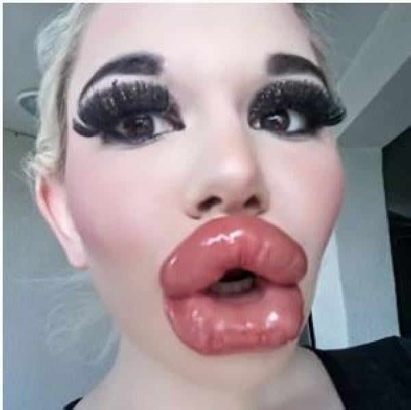 Barbie’ye özenip bıçak altına yattı