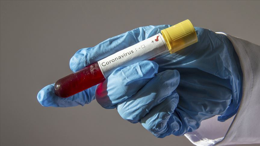 Sistem sarsılınca Covid-19 test stratejisi güncellendi: Kriterler değiştirildi