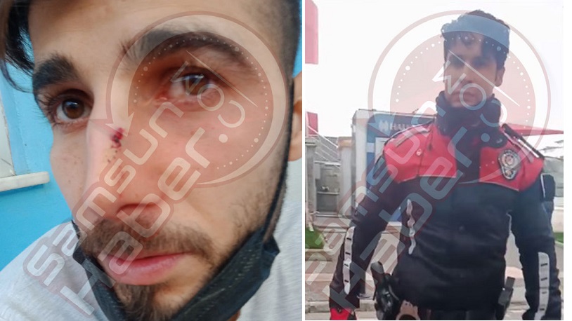 Eşini hastaneye götüren adam polisten yumruk yedi!
