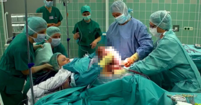 Bebeğini karnından kendisi çıkardı