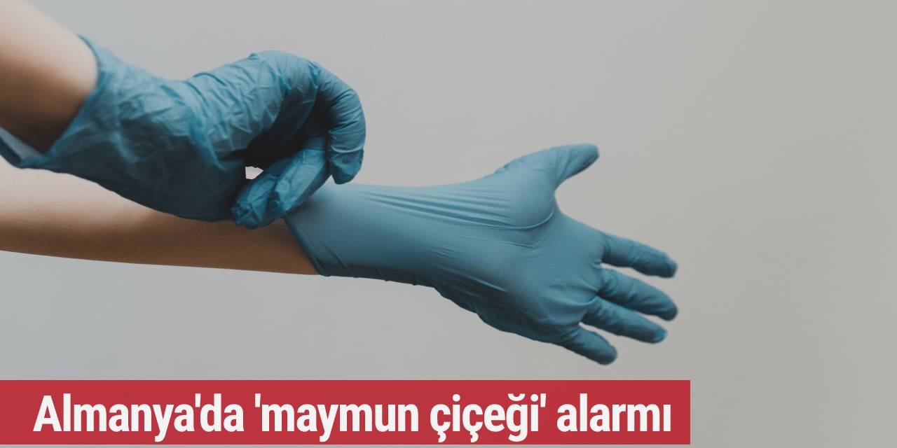 Almanya'da 'maymun çiçeği' alarmı