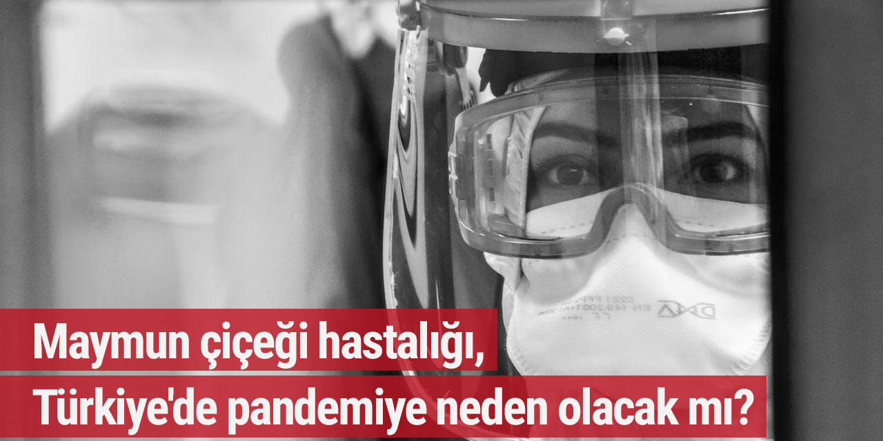 Maymun çiçeği hastalığı, Türkiye'de pandemiye neden olacak mı?