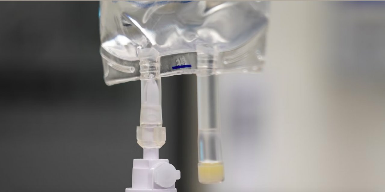 İspanya'da maymun çiçeği vaka sayısı 51'e çıktı