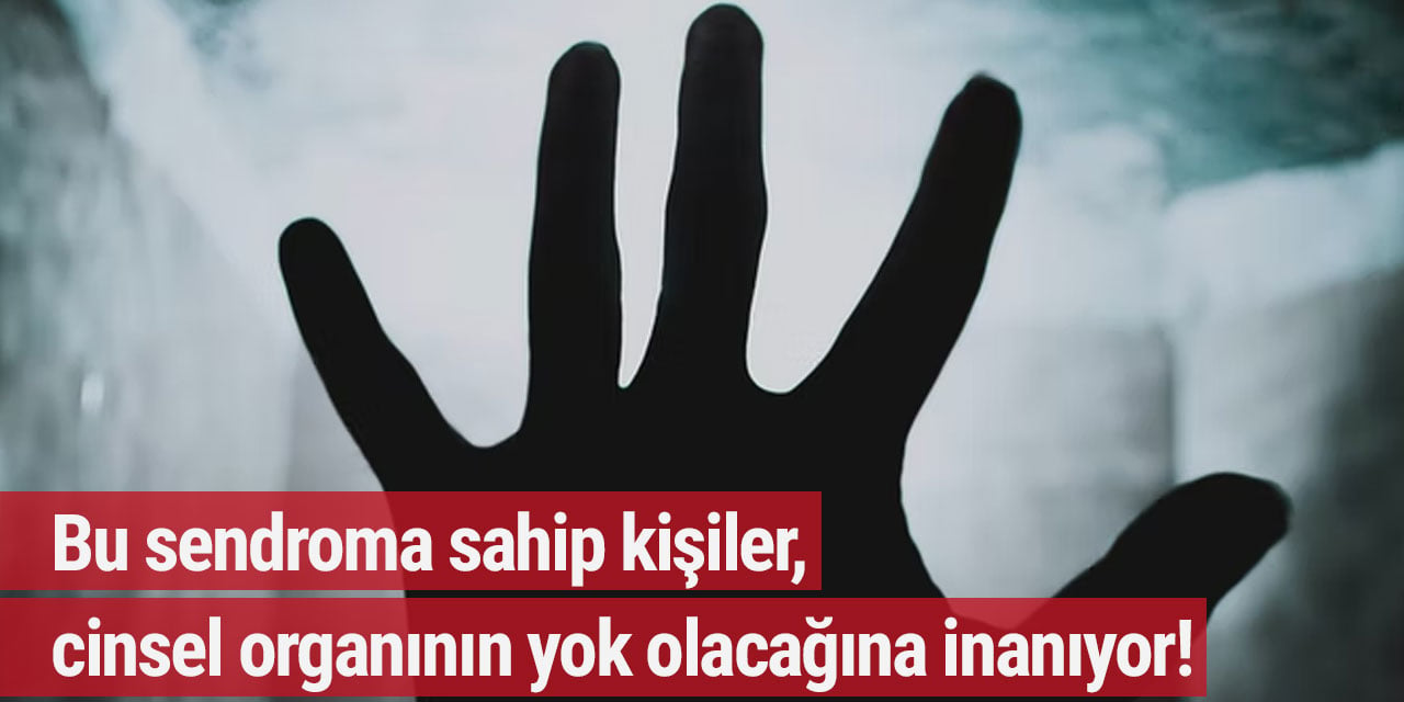 Bu sendroma sahip kişiler, cinsel organının yok olacağına inanıyor!