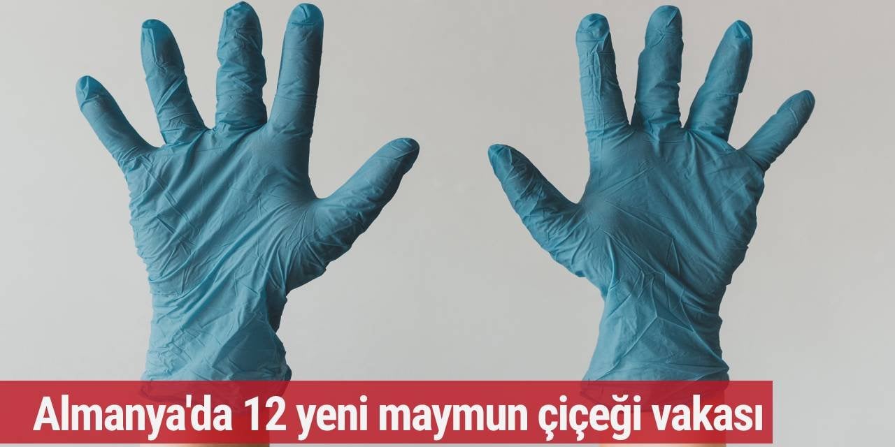 Almanya'da 12 yeni maymun çiçeği vakası