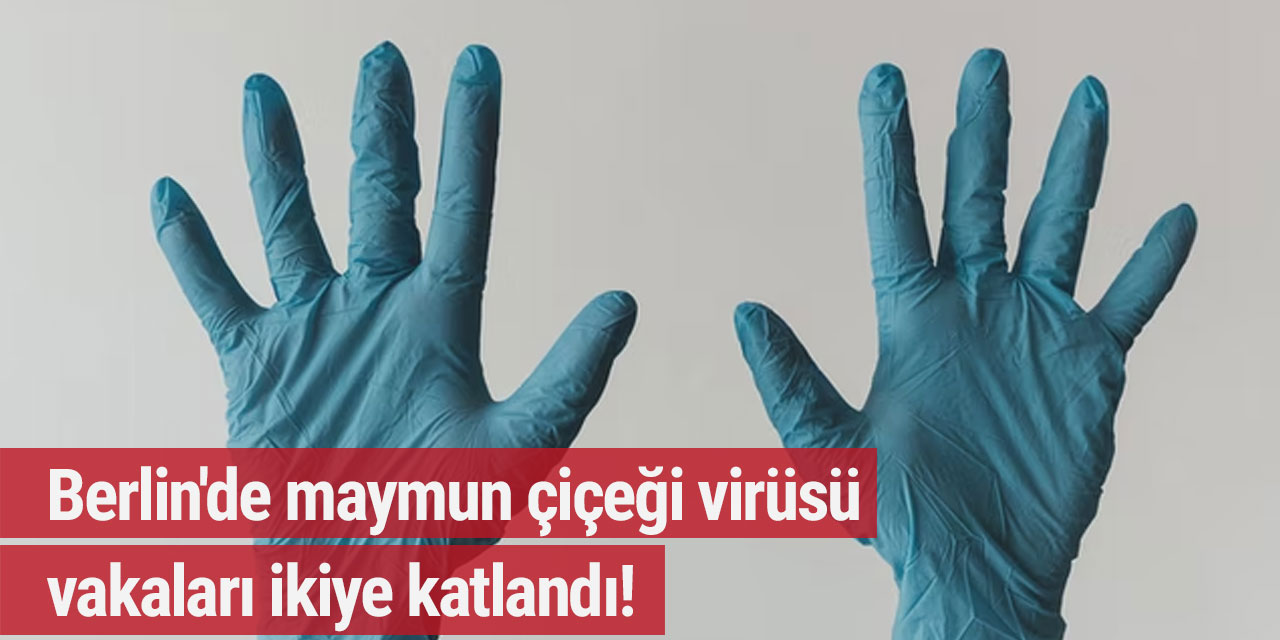 Berlin'de maymun çiçeği virüsü vakaları ikiye katlandı!