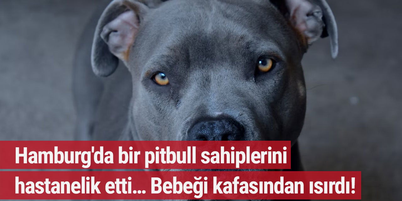 Hamburg'da bir pitbull sahiplerini hastanelik etti… Bebeği kafasından ısırdı!