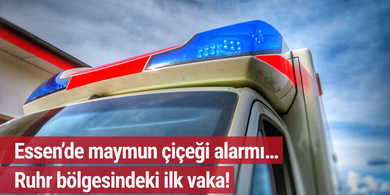 Essen’de maymun çiçeği alarmı… Ruhr bölgesindeki ilk vaka!
