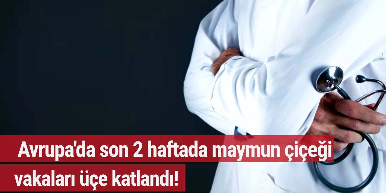 Avrupa'da son 2 haftada maymun çiçeği vakaları üçe katlandı!