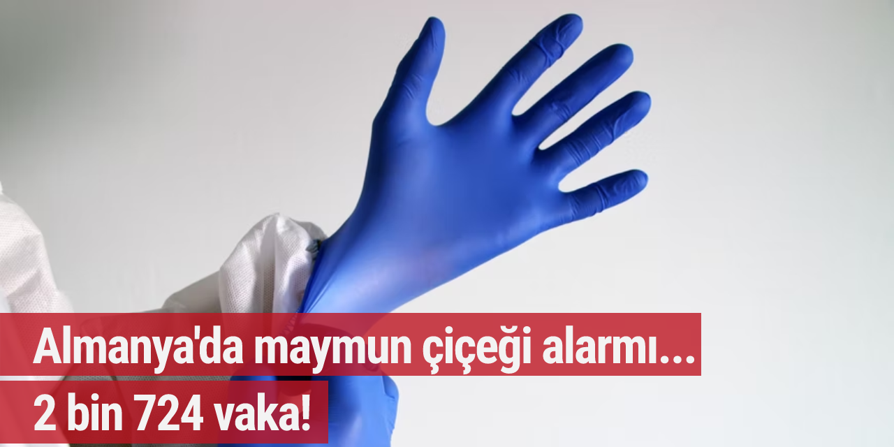 Almanya'da maymun çiçeği alarmı... 2 bin 724 vaka!