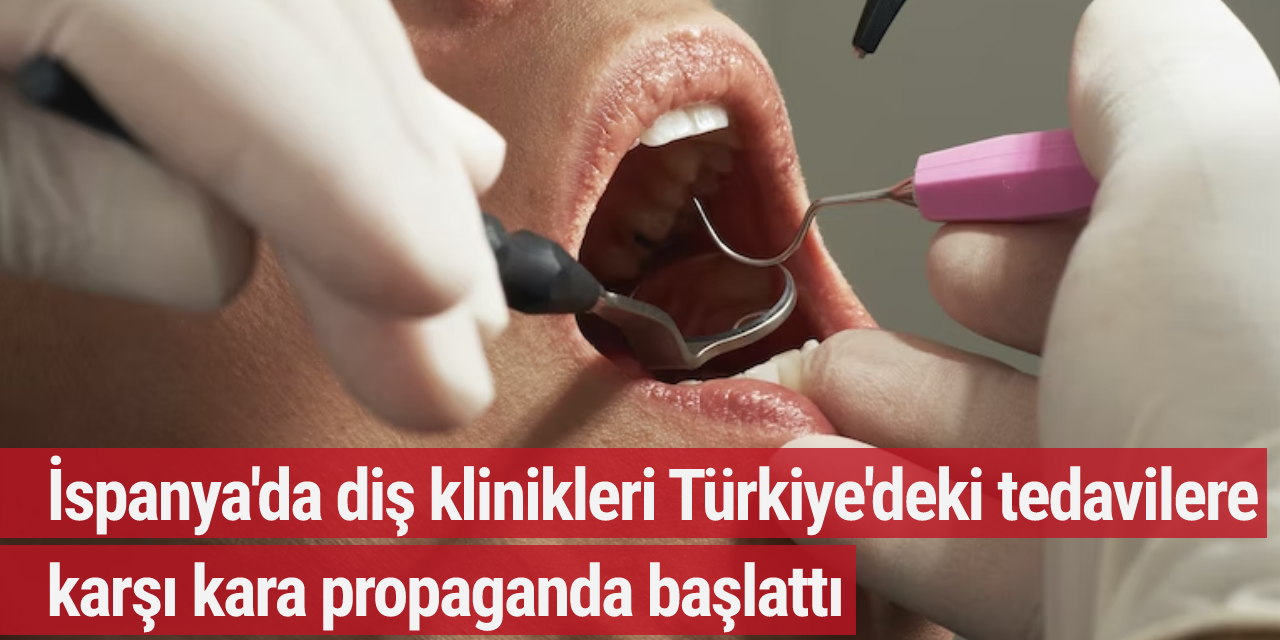 İspanya'da diş klinikleri Türkiye'deki tedavilere karşı kara propaganda başlattı