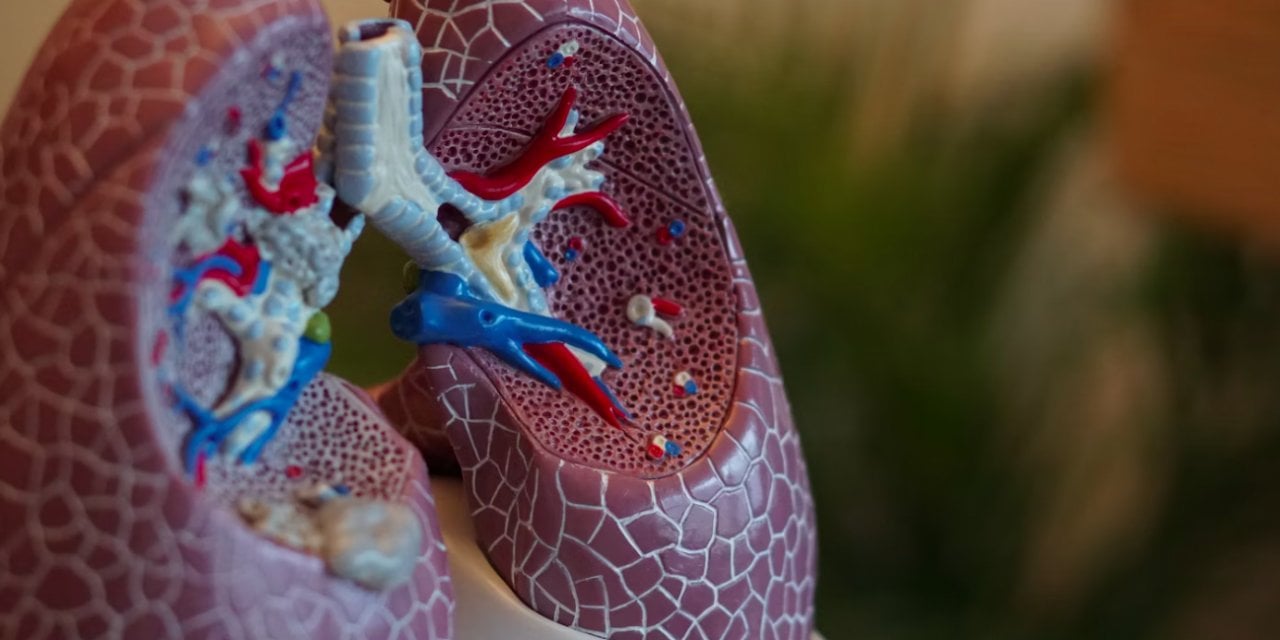 BioNTech'ten akciğer kanseri ilacıyla ilgili sevindiren haber