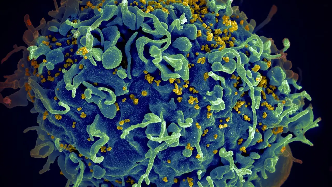 Federal hükümet HIV ilacı kıtlığı ilan etti