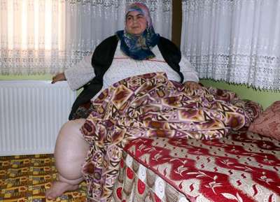 230 kiloyla hapis hayatı yaşıyor