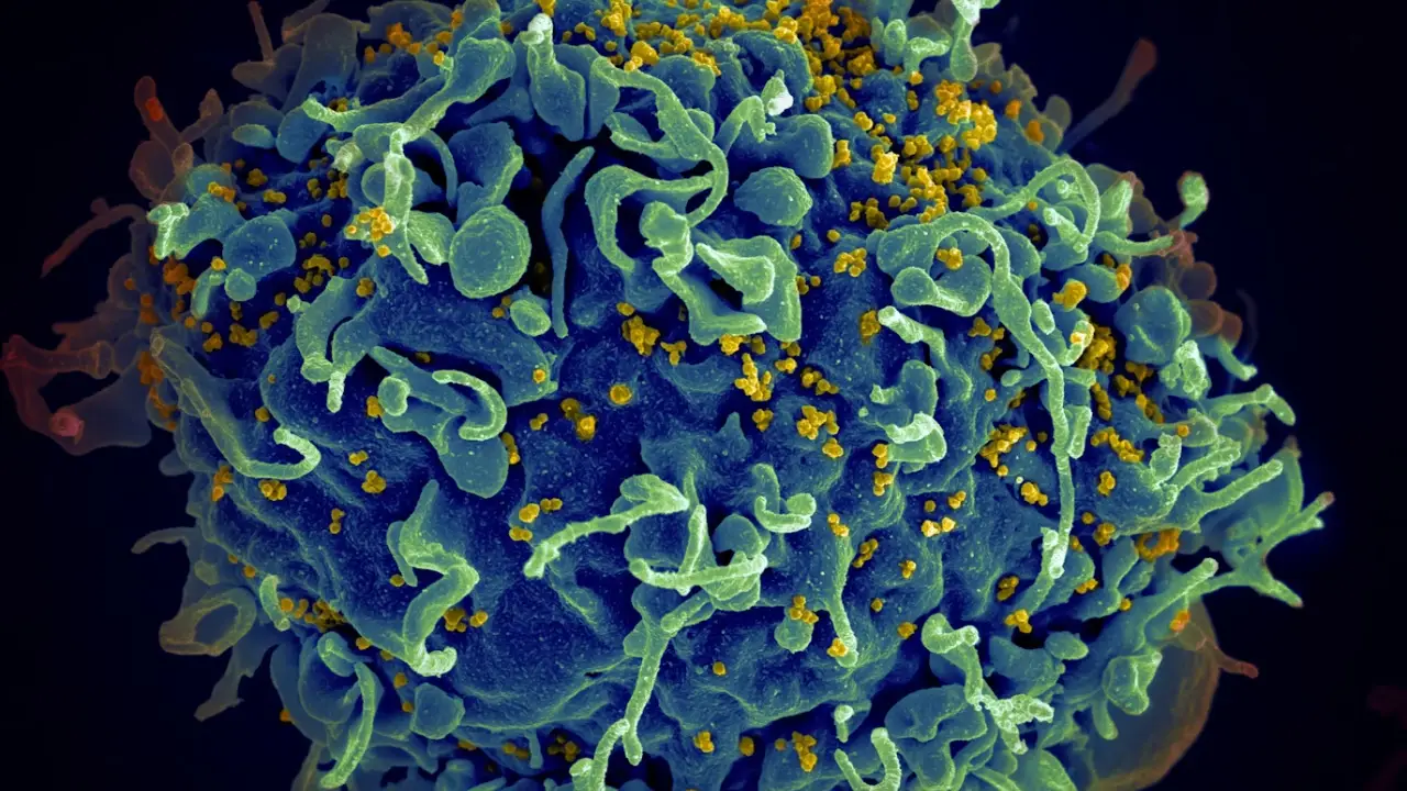 Almanya'nın o eyaletinde HIV vaka sayısında rekor artış