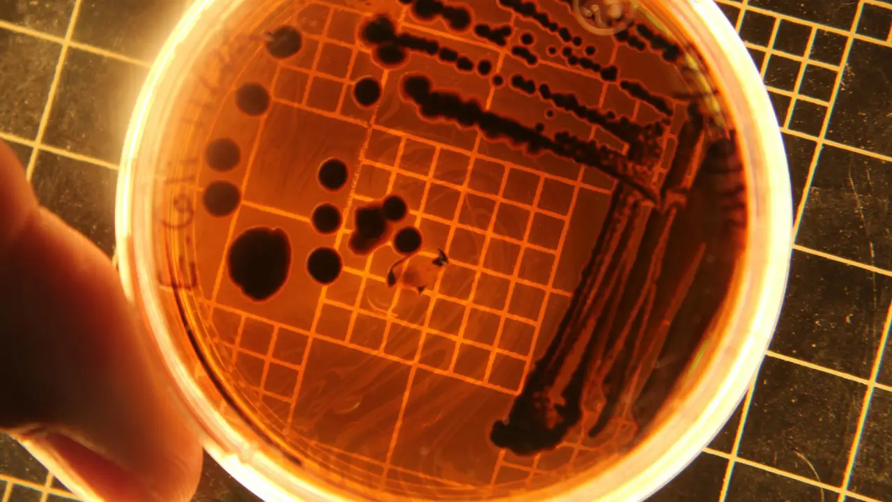 Müller mağazalarında satılan üründe salmonella riski