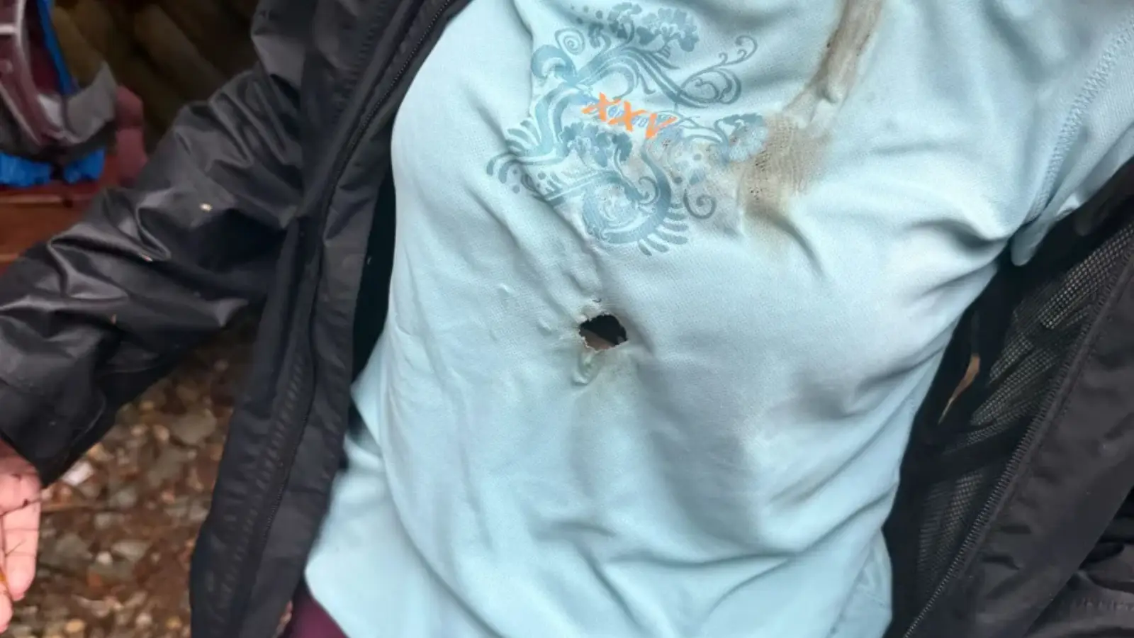 Alman turistin göğsüne yıldırım düştü