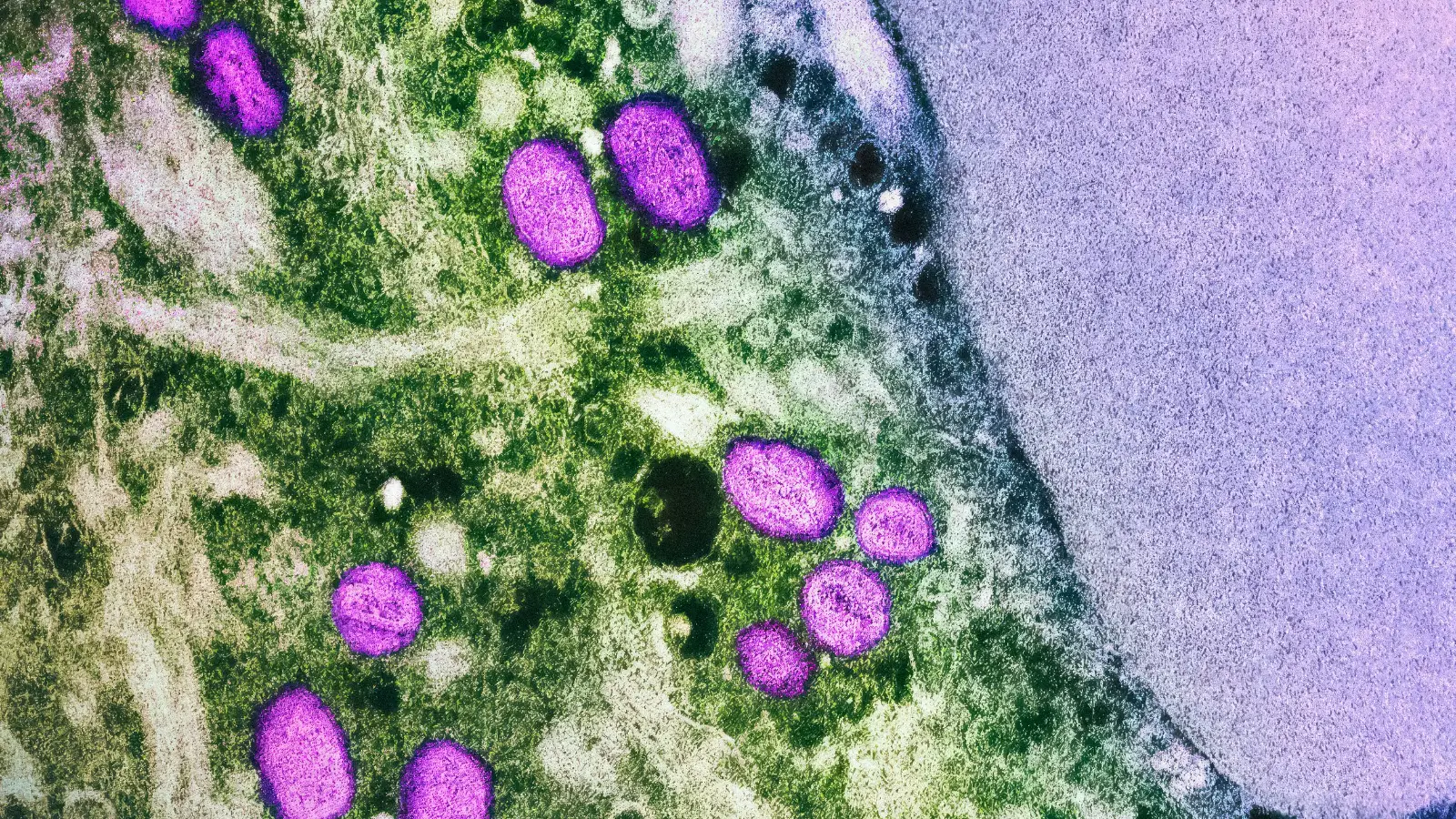 Mpox vakaları Berlin’de geçen yılı şimdiden geride bıraktı