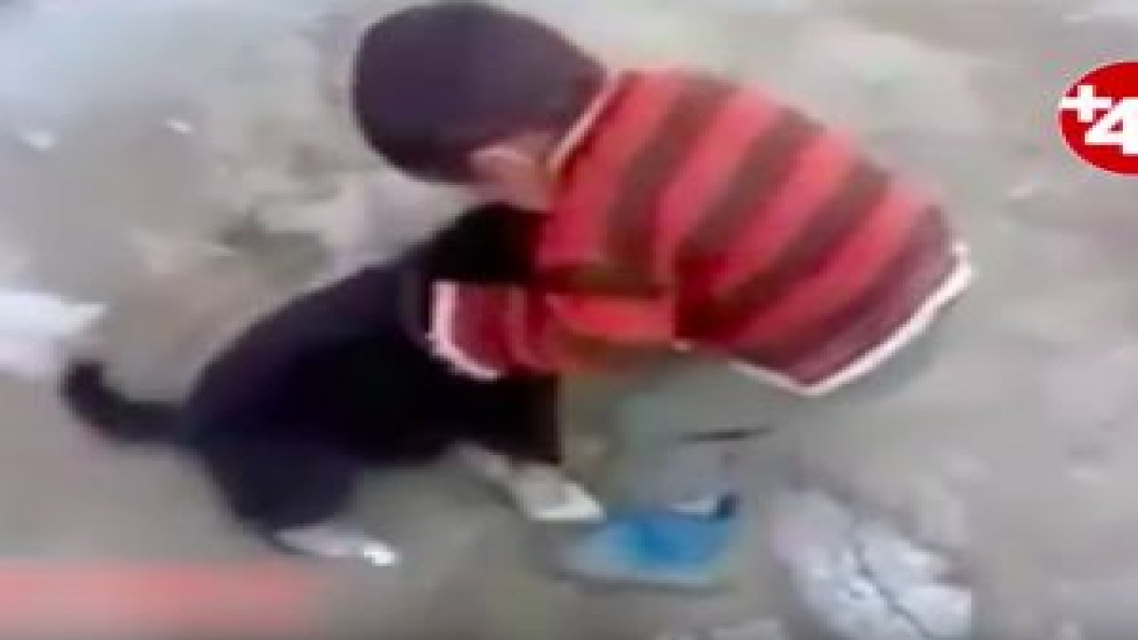 Köpek çocuğu, çocuk da köpeği böyle ısırdı