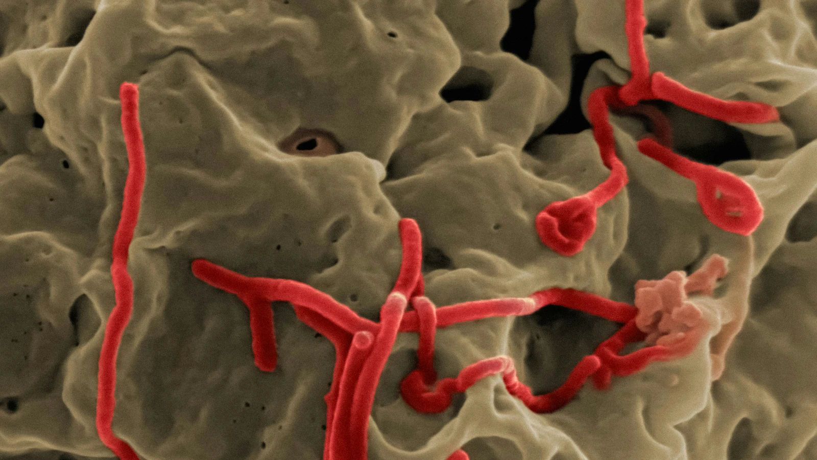 Kongo, Ebola salgınının sona erdiğini ilan etti