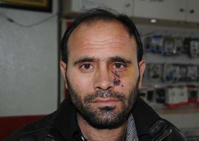 Silahlı soygun girişimi kameralara yansıdı