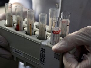 Doping testinde tümör çıktı