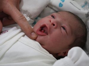 İki dişli doğan bebek şaşırttı