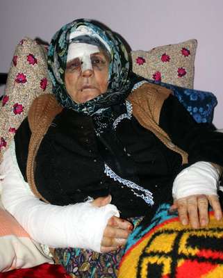 Maskeli saldırgan 76 yaşındaki kadını dövüp, parmağındaki yüzüğü aldı