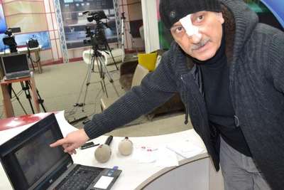 ÇÖKEN ÇATININ ALTINDAN YARALI KURTULAN ESNAF: "FİLMLERDE GÖRDÜĞÜM MANZARAYI YAŞADIM"