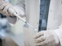 Rusya’da 38 milyon kişiye HIV testi yapıldı