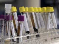 Hepatit yılda 1,4 milyon can alıyor
