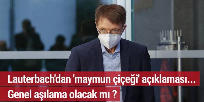 Lauterbach'dan 'maymun çiçeği' açıklaması... Genel aşılama olacak mı ?