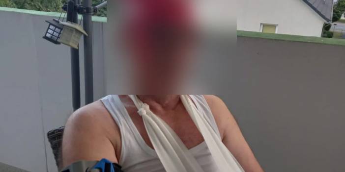 ARTI49'a konuştu, politikacılara seslendi: Köln'de yaşayan Türk vatandaşı durduk yere sokakta saldırıya uğradı