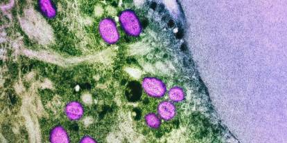 Mpox vakaları Berlin’de geçen yılı şimdiden geride bıraktı